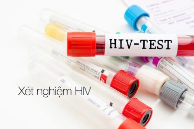 test-hiv-nhanh