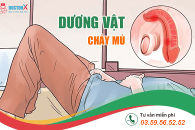 dương vật chảy mủ