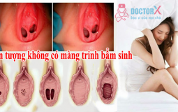 hien-tuong-khong-co-mang-trinh-bam-sinh