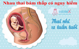 nhau-thai-bam-thap-co-nguy-hiem