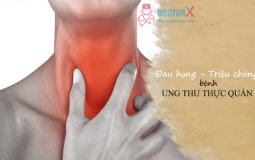 ung-thu-thuc-quan-song-bao-lau