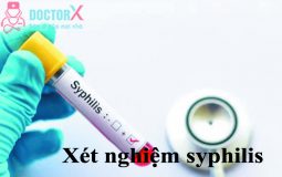 xet-nghiem- syphilis2