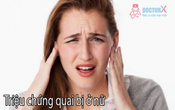 trieu-chung-quai-bi-o-nu